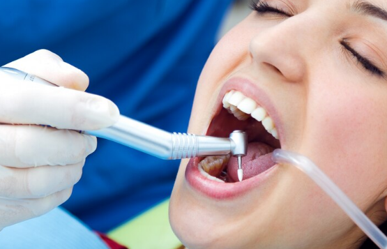 Best Teeth Filling Services in Noida