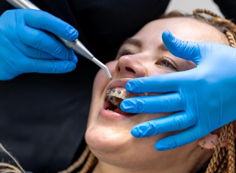 Best Teeth Braces Treatment in Greater Noida