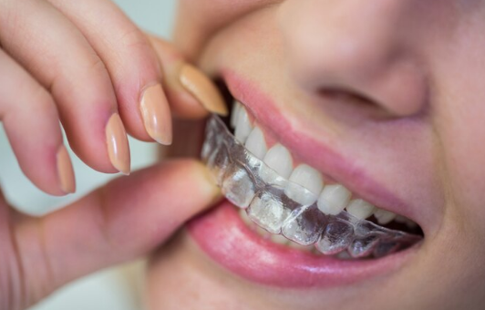 Best Teeth Clear Aligners Service in Greater Noida