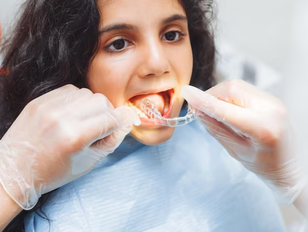 Best Dentist for Clear Aligners in Greater Noida