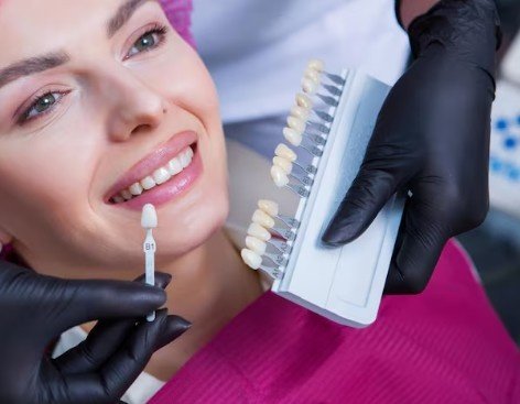 Best Dental Porcelain Veneers Treatment in Noida