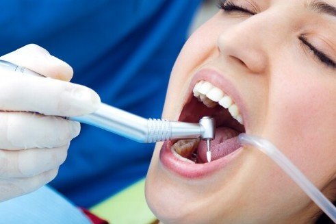 Best Teeth Filling Services in Greater Noida West