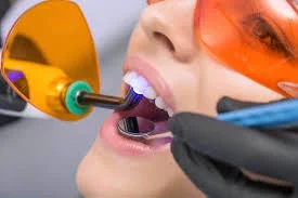 Laser Tooth Extraction in Greater Noida West