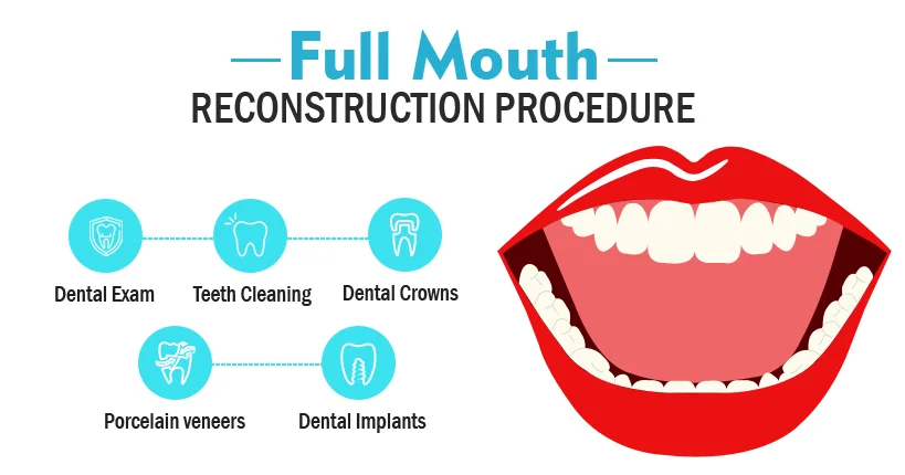 Full Mouth Rehabilitation in Greater Noida West