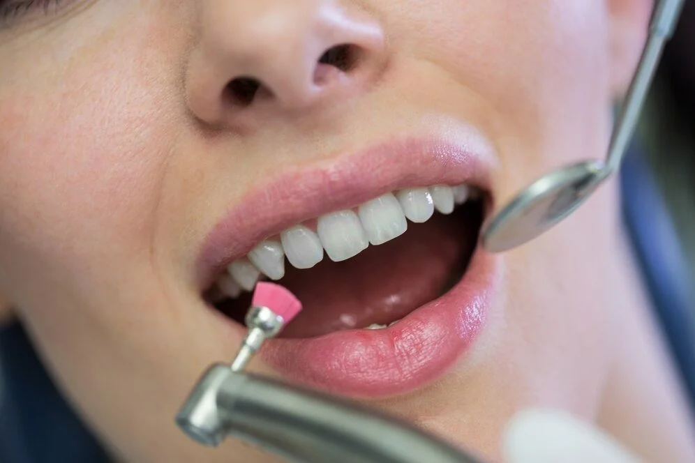 Best Fillings Service Doctors in Greater Noida