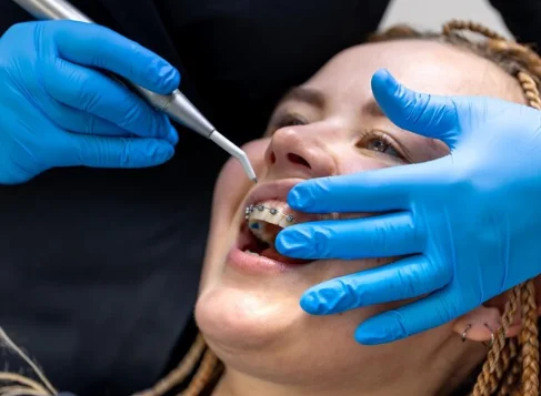 Best Teeth Braces Treatment in Greater Noida