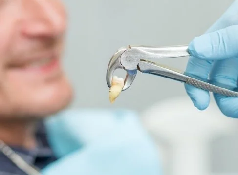 Best Tooth Extraction Service in Greater Noida West