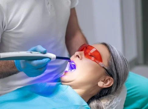 Best Teeth Whitening Service in Noida