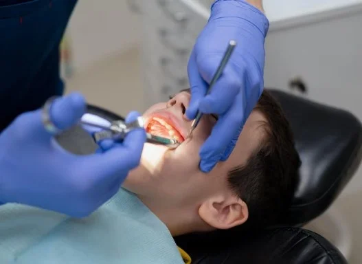 Best Wisdom Teeth Extraction Service in Noida