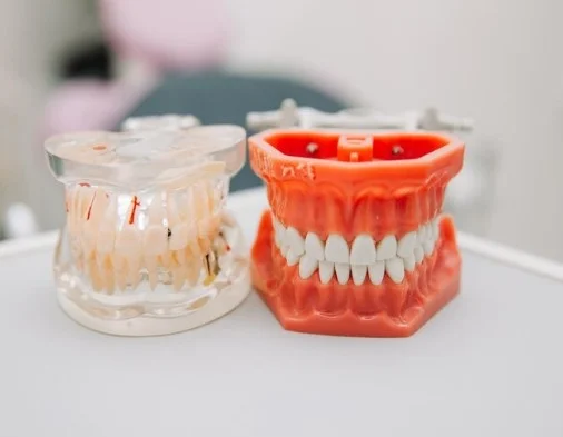 Best Complete Partial Dentures in Noida
