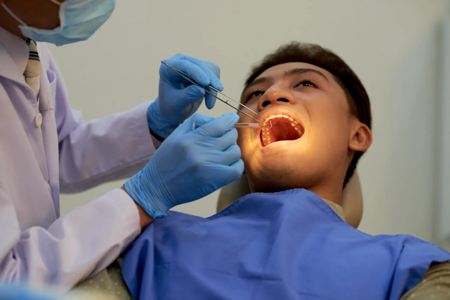 Best Wisdom Teeth Extraction Treatment in Greater Noida
