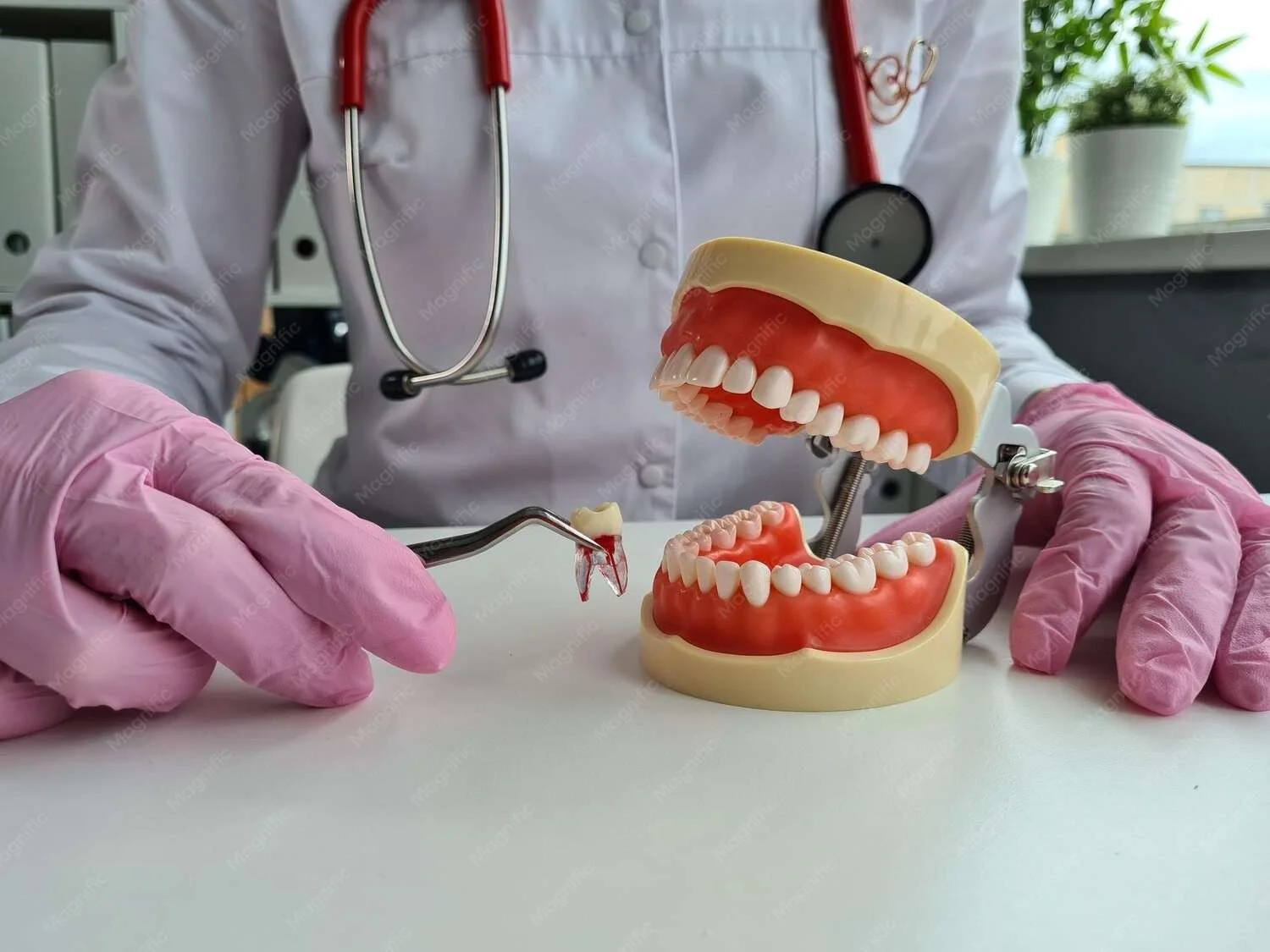 Best Complete Partial Dentures Treatment in Noida