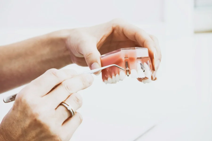Dentist demonstrating a dental implant model with a titanium implant and crown during a patient consultation.