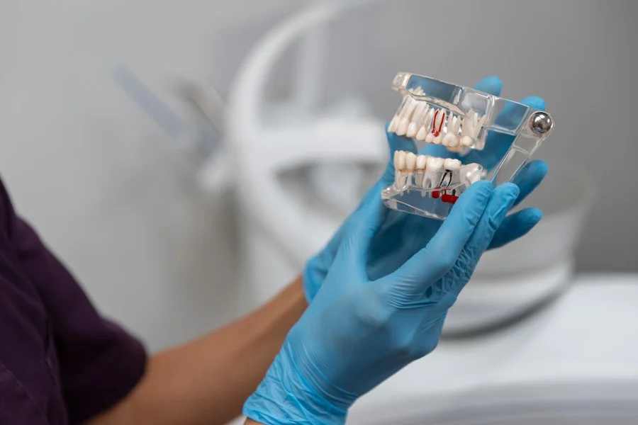 Dentist holding a dental model to explain tooth roots and jawbone structure before dental implant treatment